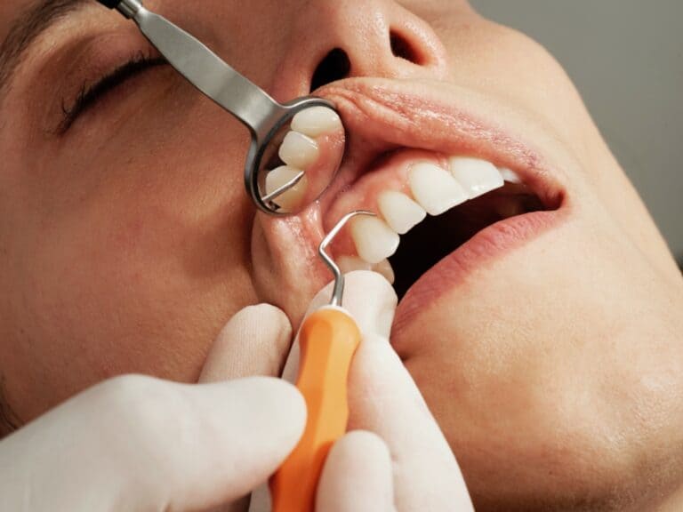 Proceso de alineación dental con alineadores invisibles